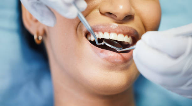Best Emergency Dentist for Lost Fillings or Crowns in Monroeville, AL