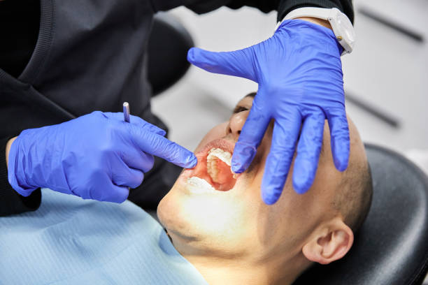 Best Emergency Dental Extractions in Monroeville, AL